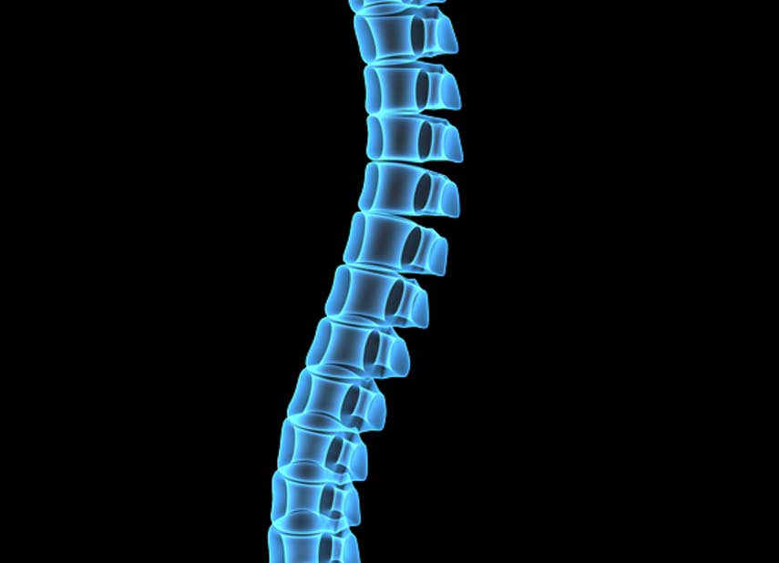 spinal-fusion-universal-care-personal-injury