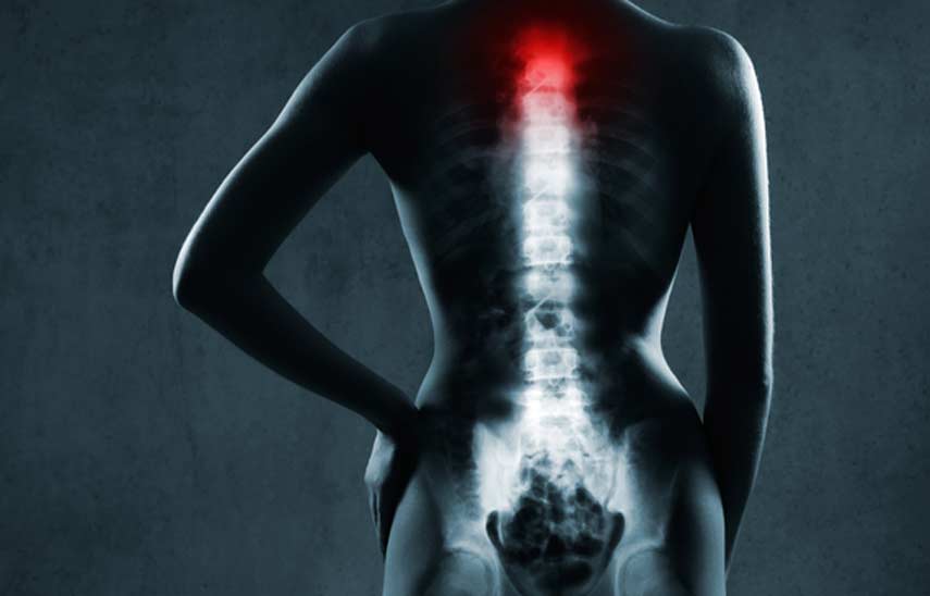 spinal-x-rays-universal-care-personal-injury